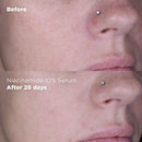 Brightening Niacinamide 10% and Zinc 1% Serum