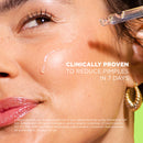 Oil Control & Anti-Spot Salicylic Acid 2% Serum