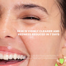 Oil Control & Anti-Spot Salicylic Acid 2% Serum