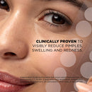 Spot Clear Anti-Pimple Patches with Salicylic Acid